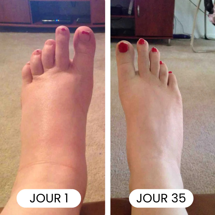 Lynvea Detox-Tropfen – Natürliche Linderung bei Wassereinlagerungen im Gesicht, Bauch und an den Beinen