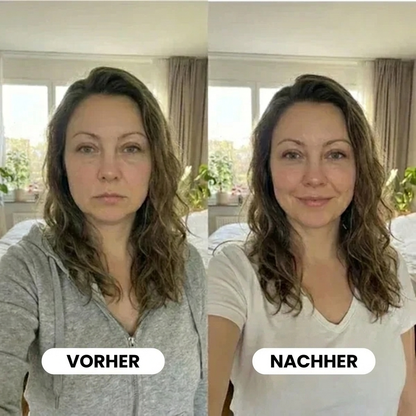 Lynvea Detox-Tropfen – Natürliche Linderung bei Wassereinlagerungen im Gesicht, Bauch und an den Beinen